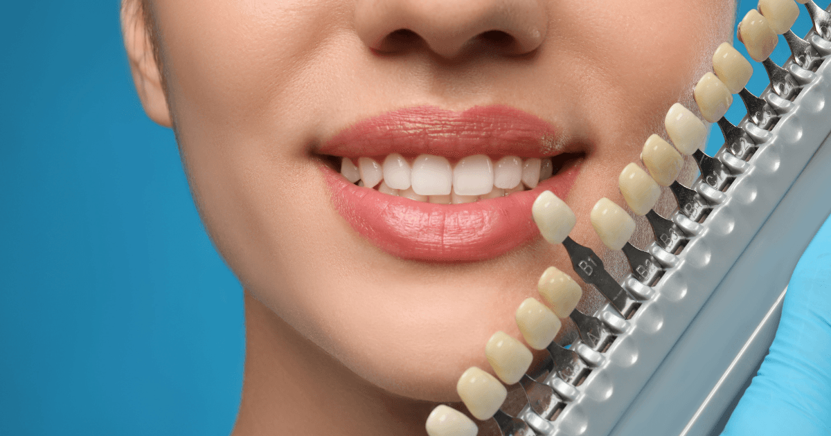 Aesthetic Dentistry