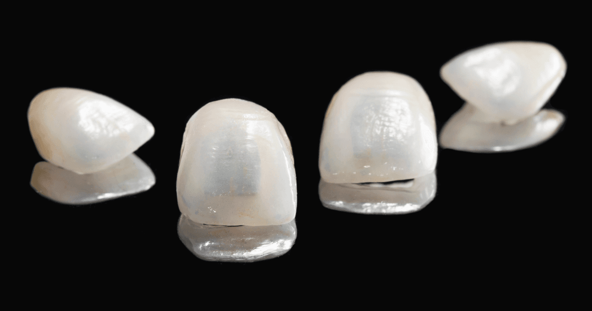 Porcelain Veneers